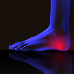 The Most Common Causes of Heel Pain
